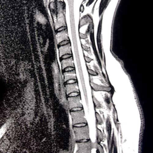 Globally Trained Surgeons