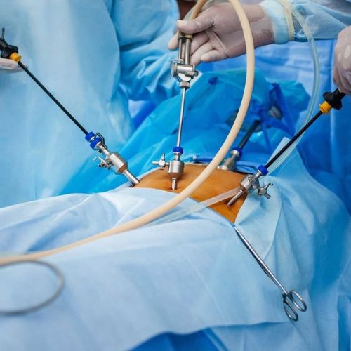 Endoscopic Spine Surgery at Stavya