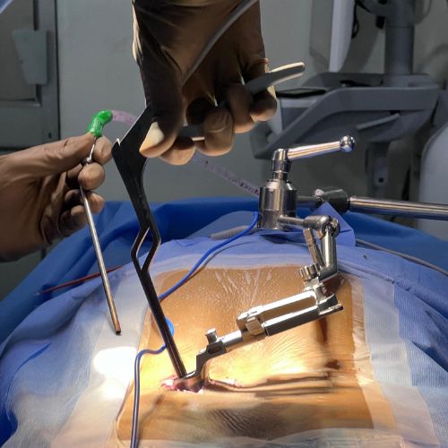 Persistent nerve compression or stiffness