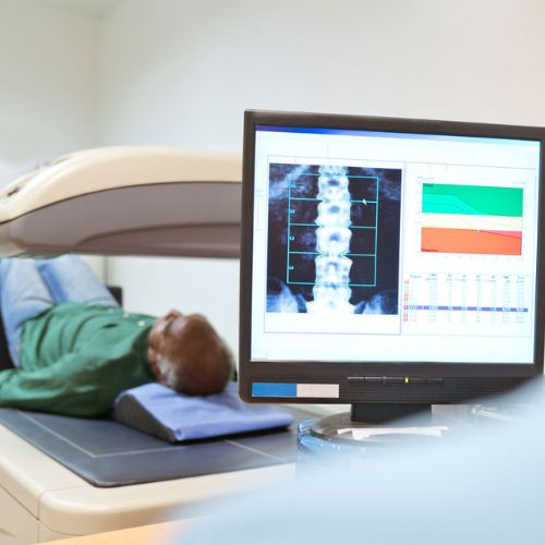 DEXA Scan