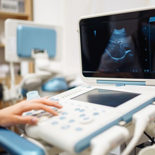 Sonography